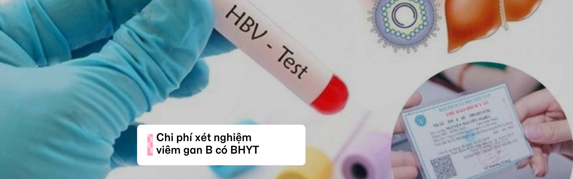Xét nghiệm viêm gan B có được bảo hiểm y tế chi trả không? [Cập nhật 2025-2026]