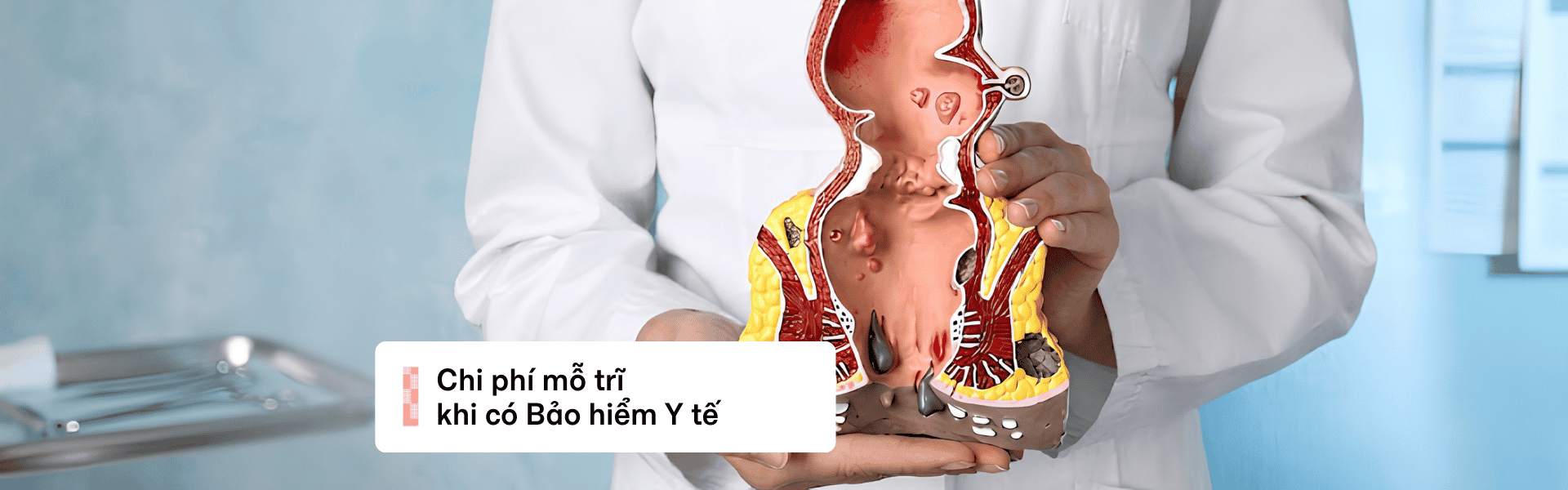 Chi phí mổ trĩ có bảo hiểm y tế là bao nhiêu? Mức hưởng chi tiết