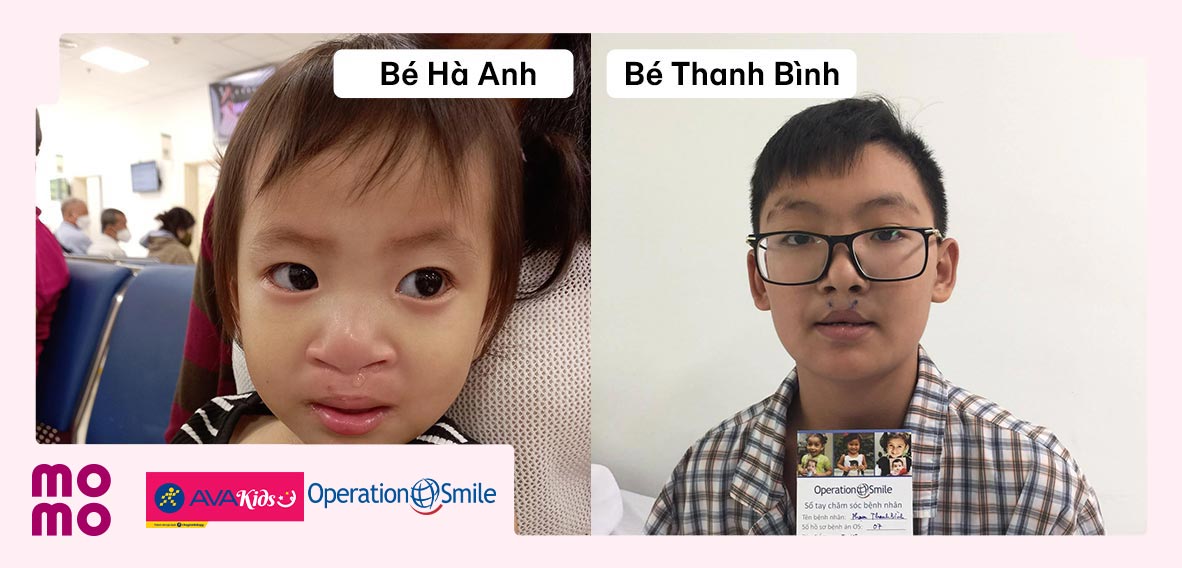 Mang tặng nụ cười lành lặn cho các em nhỏ kém may mắn