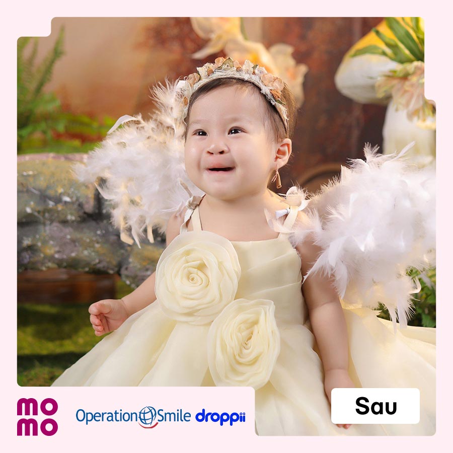 Mang lại nụ cười mới cho 80 em bé hở môi, hàm ếch