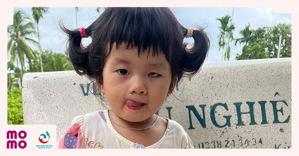 Bé Đào Tuệ Ngân, 2 tuổi, đã phải loại bỏ mắt trái do U nguyên bào võng mạc