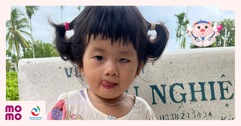 Bé Đào Tuệ Ngân, 2 tuổi, đã phải loại bỏ mắt trái do U nguyên bào võng mạc