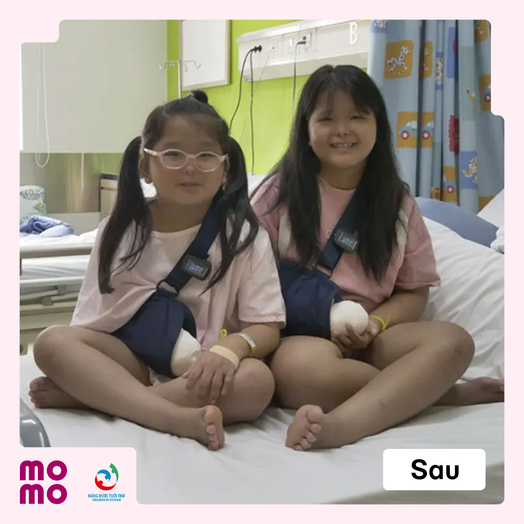 San sẻ chi phí phẫu thuật để giúp các em có một cuộc sống lành lặn và hạnh phúc