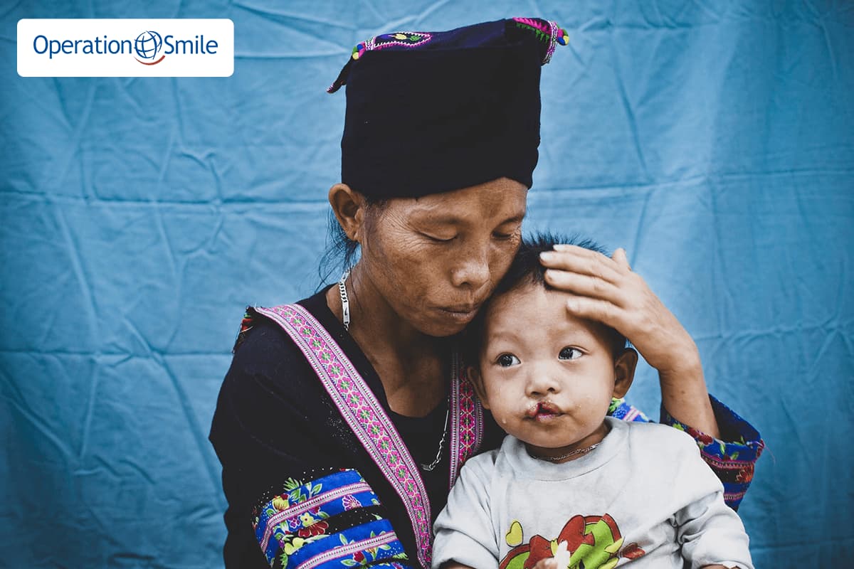 Mỗi năm có hơn 3000 trẻ em sinh ra với các dị tật hàm mặt phải chịu tổn thương vì sự kỳ thị, xa lánh của xã hội