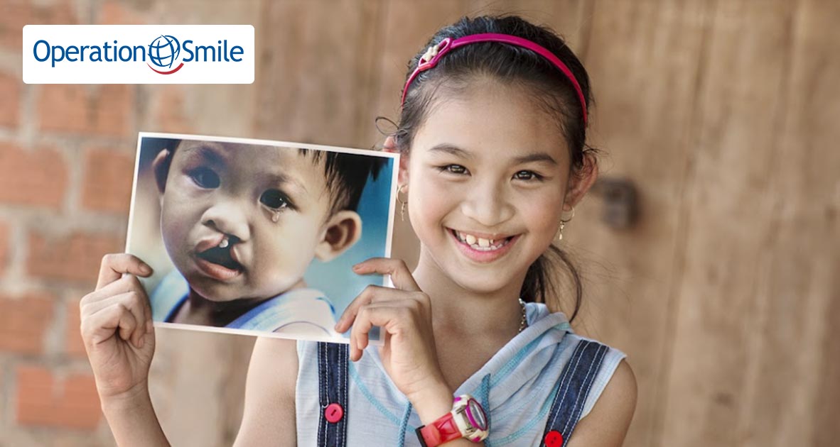 Cùng Operation Smile chung tay mang đến 20 ca phẫu thuật tái tạo nụ cười cho các em bé hở môi, hàm ếch trên khắp Việt Nam, để các em có thể viết tiếp câu chuyện tươi đẹp của chính mình
