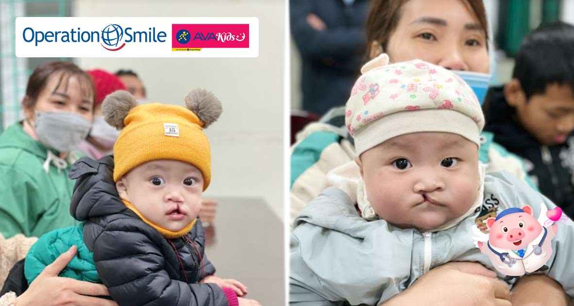 Chương trình phẫu thuật của Operation Smile đã mang đến cơ hội chữa lành cho nhiều em nhỏ kém may mắn - 2