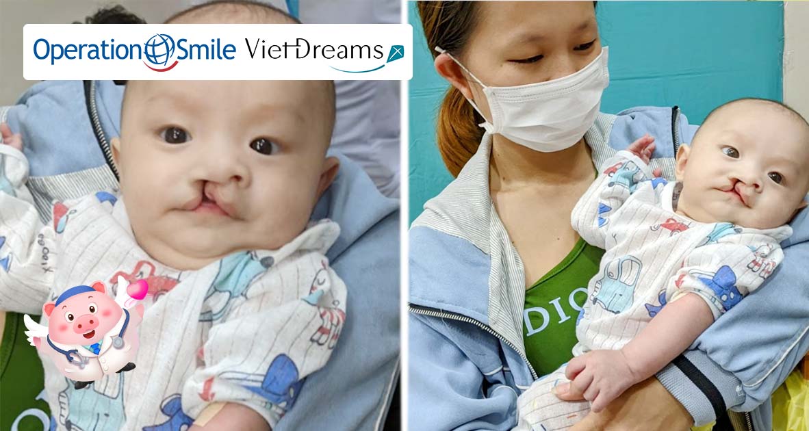 Chung tay góp Heo Vàng cùng Quỹ Viet Dreams tặng 80 ca phẫu thuật miễn phí cho các em bé hở môi, hàm ếch
