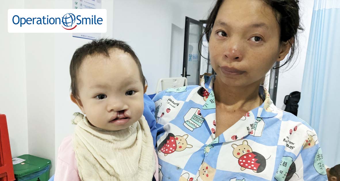 Gây quỹ trao tặng 20 nụ cười mới cho các em nhỏ hở môi, hàm ếch (Tháng 1/2024)