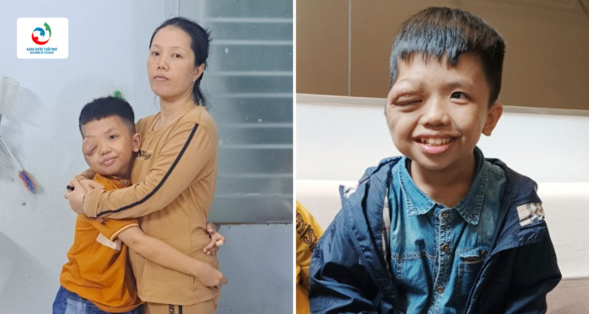 Mang phép mầu y tế giúp cậu bé Bảo Thiên sớm được phẫu thuật để bé được hòa nhập cuộc sống như các bạn đồng trang lứa.