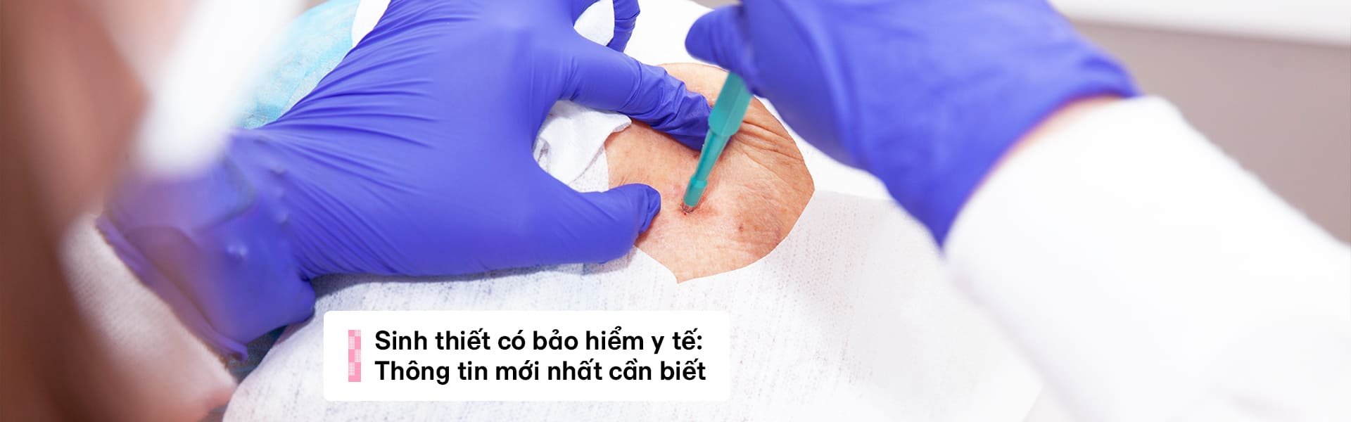 Sinh thiết có bảo hiểm y tế: Quyền lợi & Thông tin cần biết