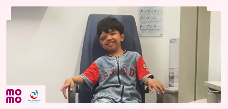 Giúp bé Bảo Thiên điều trị khối u sợi thần kinh