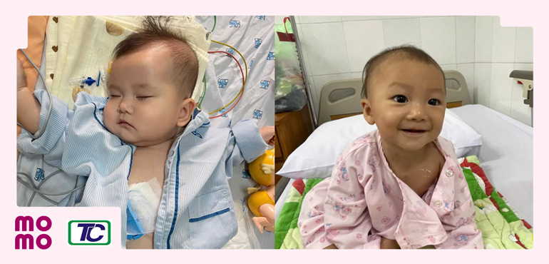 Thành công hỗ trợ chi phí phẫu thuật tim cho 20 em nhỏ có hoàn cảnh khó khăn