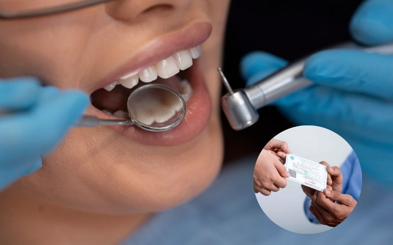 Tìm hiểu mức hưởng BHYT trám răng theo luật mới nhất